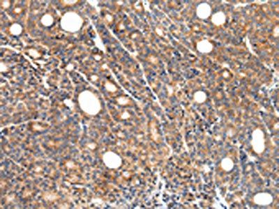 ZFP30 Antibody
