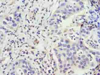 ZFP69B Antibody
