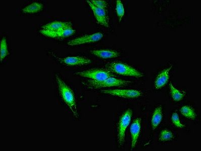 ZFYVE16 Antibody