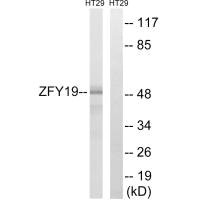 ZFYVE19 Antibody