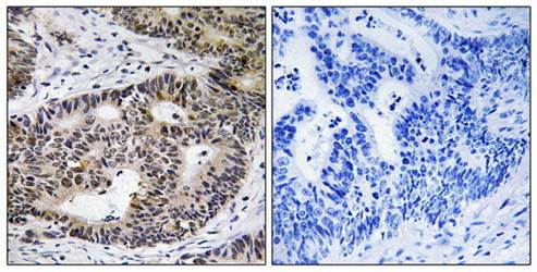ZFYVE19 Antibody