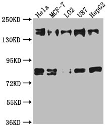 ZFYVE9 Antibody