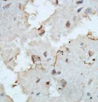 ZFYVE9 Rabbit Polyclonal Antibody