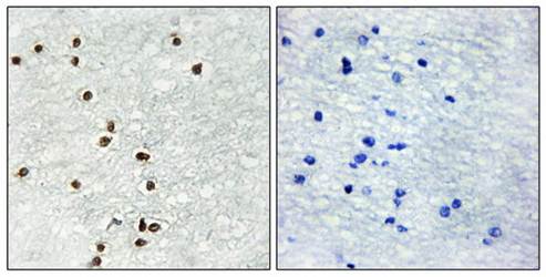 ZIC1/2/3 Antibody
