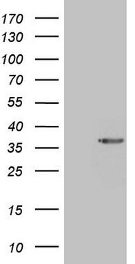 ZIC3 Antibody