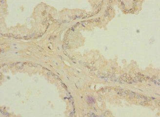 ZIC3 Antibody