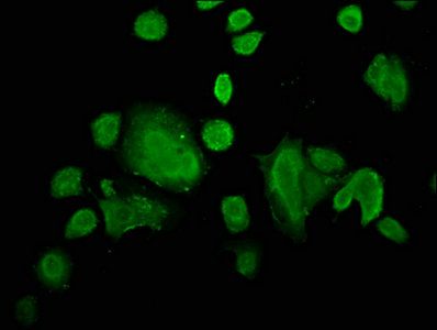 ZIC4 Antibody