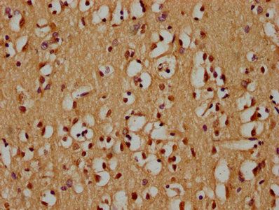 ZIM2 Antibody