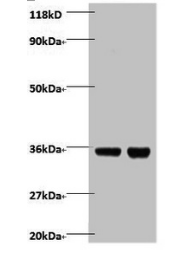 Zinc finger BED domain-containing protein 1 protein antibody
