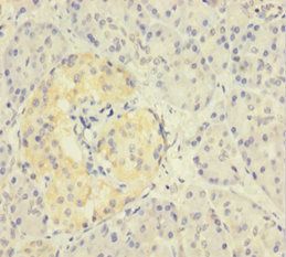ZNF114 Antibody
