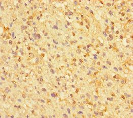 ZNF384 Antibody