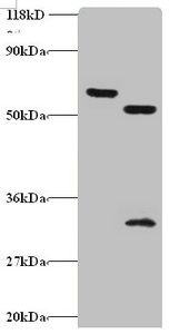 Zinc finger protein 384 antibody