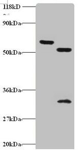 ZNF384 Antibody