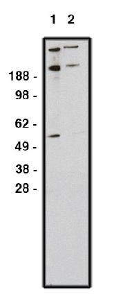 Rabbit Human Zinc Finger Protein GLI1 Antibody