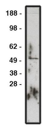 Rabbit Human Zinc Finger Protein GLI1 Antibody