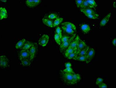 Zinc finger protein GLI1 antibody