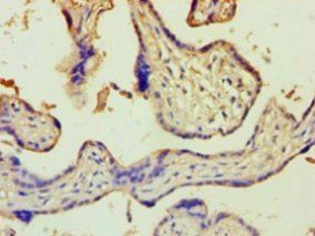 ZRANB2 Antibody