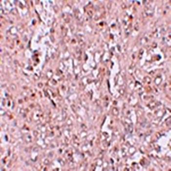ZIP13 Antibody