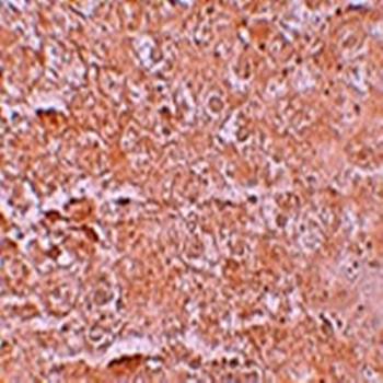 ZIP14 Antibody