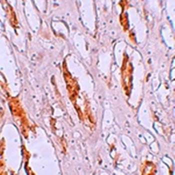 ZIP1 Antibody