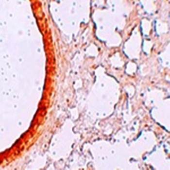 ZIP3 Antibody