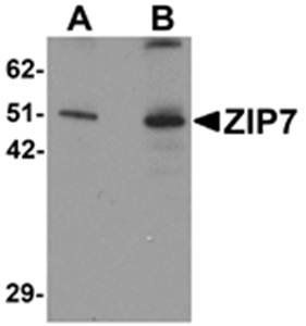 ZIP7 Antibody