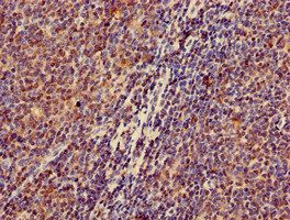 ZKSCAN3 Antibody