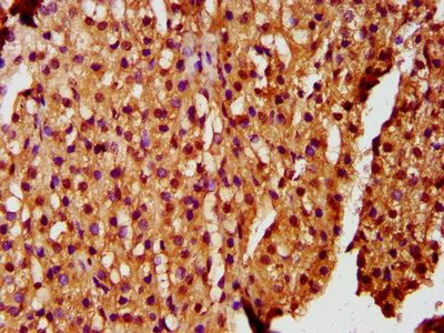 ZKSCAN5 Antibody