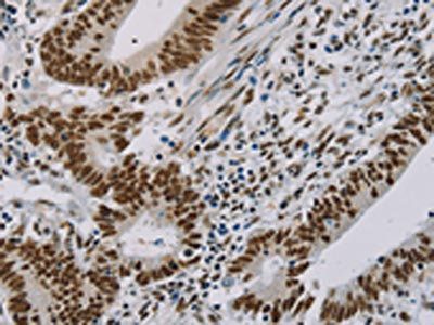 ZMAT3 Antibody