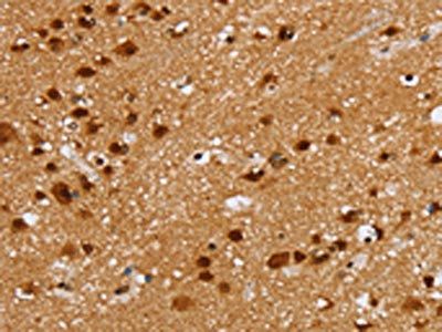 ZMAT3 Antibody