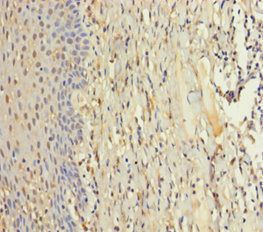 ZMAT5 Antibody