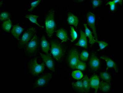 ZMIZ1 Antibody