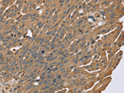 ZMIZ1 Antibody