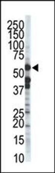 ZMPSTE24 antibody
