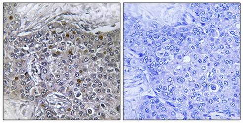ZMY11 Antibody