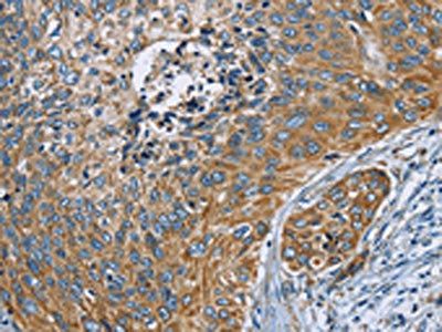 ZMYND11 Antibody