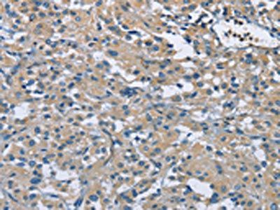 ZMYND11 Antibody