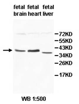 ZMYND19 Rabbit Polyclonal Antibody
