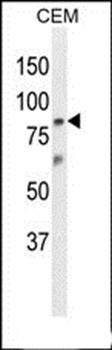 ZN160 antibody