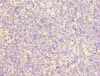 ZNF131 Antibody