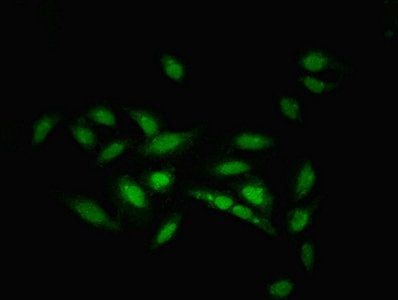 ZNF133 antibody