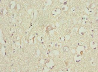 ZNF148 Antibody