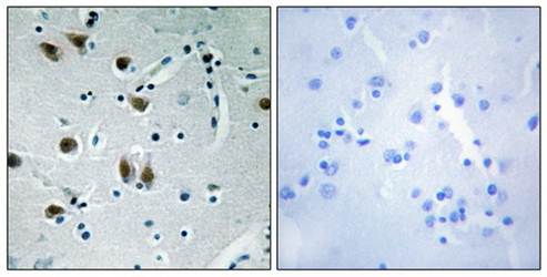 ZNF148 antibody