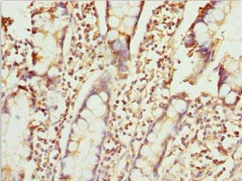 ZNF169 antibody