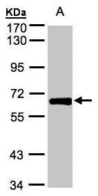 GALNT2 antibody
