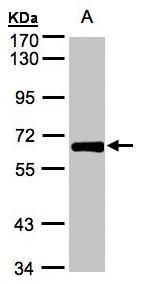 polypeptide N-acetylgalactosaminyltransferase 2 Antibody