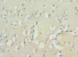 ZNF177 Antibody
