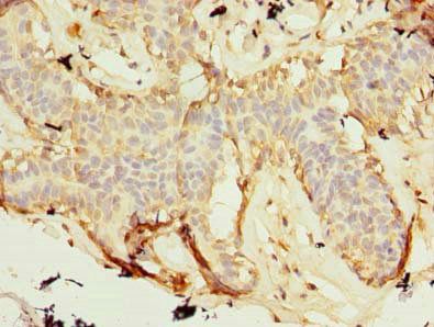 ZNF19 antibody