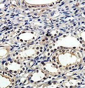 ZNF192 Rabbit Polyclonal Antibody