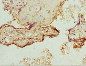 ZNF195 antibody